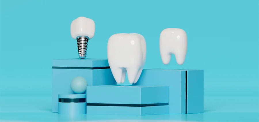 Tratamientos Dentales con Tecnologia de Ultima Generacion