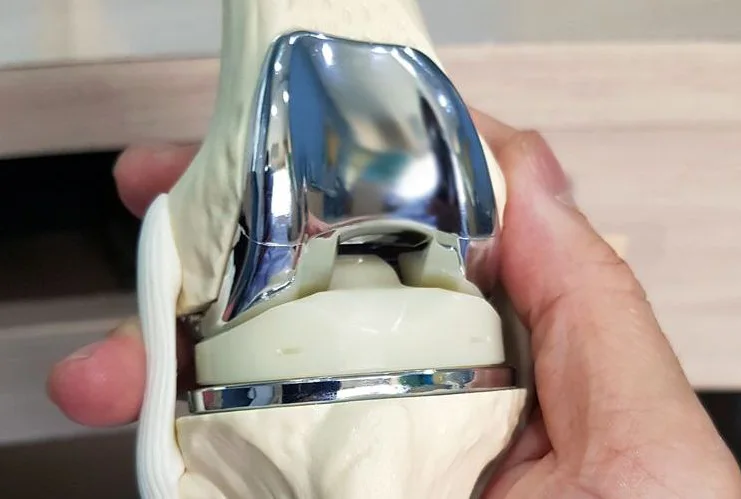 knee orthopedic Specialists in Tijuana - Ortopedistas de Rodilla en Tijuana