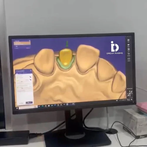 _Sonríe al futuro con la odontología digital, donde la innovación y la tecnología se unen para t